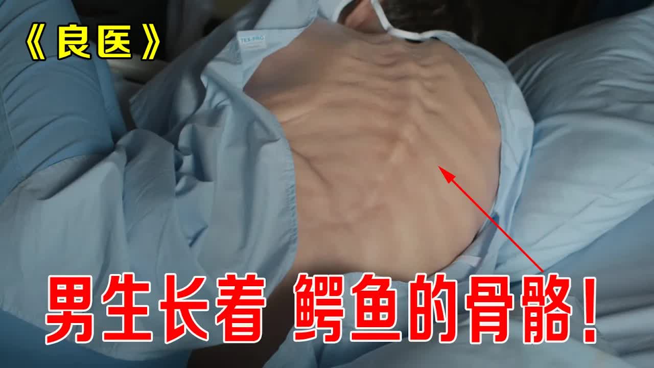 男生长着鳄鱼骨骼，被学生称为“鳄鱼男孩，罪魁祸首竟然是学校《良医》